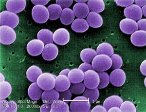 Staphylococcus aureus (foto: Wikipedia)