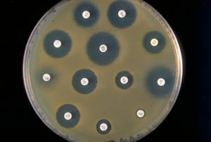 Vidljivo djelovanje antibiotika (foto: Wikimedia Commons)